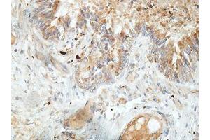 IHC analysis of formalin-fixed paraffin-embedded fetal lung, using TTC25 antibody (1/100 dilution). (TTC25 抗体  (AA 47-236))