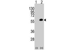 Western blot analysis of MEF2C (arrow) using rabbit MEF2C polyclonal antibody . (MEF2C 抗体  (Thr300))
