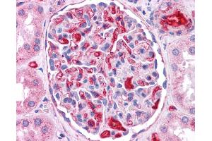ApoE antibody was used for immunohistochemistry at a concentration of 4-8 ug/ml. (APOE 抗体  (N-Term))