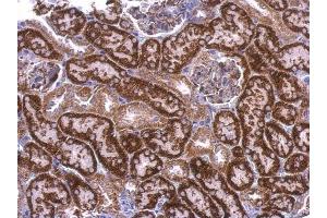 IHC-P Image EDG7 antibody [N3C2], Internal detects EDG7 protein at cytosol on mouse kidney by immunohistochemical analysis. (LPAR3 抗体)