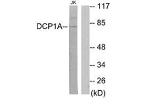 Western blot analysis of extracts from Jurkat cells, using DCP1A Antibody. (DCP1A 抗体  (AA 111-160))