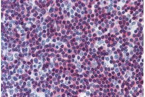 Human Tonsil: Formalin-Fixed, Paraffin-Embedded (FFPE) (CAMK4 抗体  (AA 1-474))