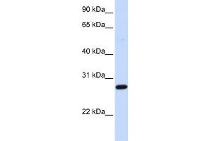 WB Suggested Anti-DCK Antibody Titration: 0. (DCK 抗体  (Middle Region))