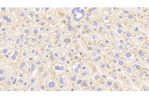 Detection of CEACAM1 in Mouse Liver Tissue using Polyclonal Antibody to Carcinoembryonic Antigen Related Cell Adhesion Molecule 1 (CEACAM1) (CEACAM1 抗体  (AA 35-143))