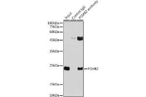 Immunoprecipitation analysis of 300 μg extracts of HeLa cells using 3 μg PSMB2 antibody (ABIN6129441, ABIN6146313, ABIN6146315 and ABIN6217703). (PSMB2 抗体  (AA 1-201))