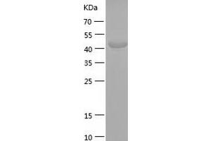 Western Blotting (WB) image for Neurexin 1 (NRXN1) (AA 59-264) protein (His-IF2DI Tag) (ABIN7124142)