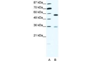 Western Blotting (WB) image for anti-GDP Dissociation Inhibitor 1 (GDI1) antibody (ABIN2463768) (GDI1 抗体)