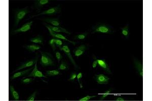 Immunofluorescence of monoclonal antibody to PAIP1 on HeLa cell.