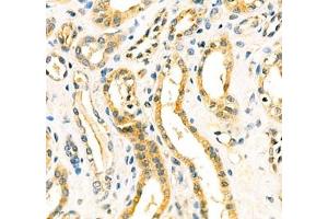 Immunohistochemistry of paraffin embedded human kidney using Aminome (ABIN7073036) at dilution of 1: 400 (400x lens) (Aminomethyltransferase 抗体)