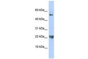 Image no. 1 for anti-Tumor Necrosis Factor (Ligand) Superfamily, Member 12 (TNFSF12) (AA 35-84) antibody (ABIN6740497)