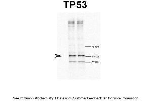 WB Suggested Anti-TP53 Antibody Titration: 1 ug/mlPositive Control: HeLa cells (p53 抗体  (N-Term))