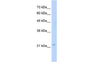 GMPR2 antibody used at 5 ug/ml to detect target protein. (GMPR2 抗体  (C-Term))