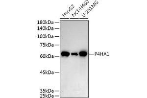 Western blot analysis of extracts of various cell lines, using P4H antibody (0538) at 1:500 dilution.
