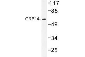 Image no. 1 for anti-Growth Factor Receptor-Bound Protein 14 (GRB14) antibody (ABIN317840) (GRB14 抗体)