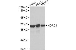 Western blot analysis of extracts of various cell lines, using HDAC1 antibody. (HDAC1 抗体)