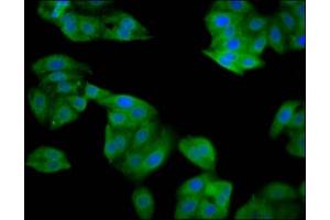 Immunofluorescence staining of HepG2 cells with ABIN7169643 at 1:133, counter-stained with DAPI. (SRP14 抗体  (AA 2-107))