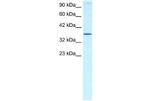WB Suggested Anti-HOXA7 Antibody Titration:  0. (HOXA7 抗体  (N-Term))