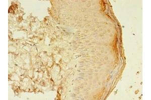 Immunohistochemistry of paraffin-embedded human skin tissue using ABIN7160224 at dilution of 1:100 (SMAD1 抗体  (AA 202-335))