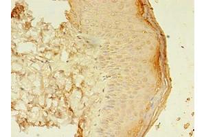 Immunohistochemistry of paraffin-embedded human skin tissue using ABIN7160224 at dilution of 1:100