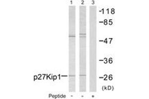 Western blot analysis of extracts from A2780 cells, using p27 Kip1 (Ab-10) Antibody. (CDKN1B 抗体  (AA 1-50))