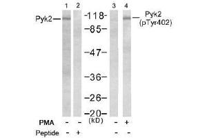 Image no. 2 for anti-PTK2B Protein tyrosine Kinase 2 beta (PTK2B) (pTyr402) antibody (ABIN196953) (PTK2B 抗体  (pTyr402))