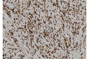 ABIN6277680 at 1/100 staining Human gastric tissue by IHC-P. (NLRP3 抗体)