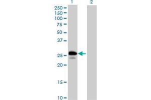 Western Blot analysis of UBE2J2 expression in transfected 293T cell line by UBE2J2 MaxPab polyclonal antibody. (UBE2J2 抗体  (AA 1-259))