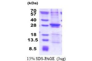 SDS-PAGE (SDS) image for Suppressor of IKBKE 1 (SIKE1) (AA 1-207) protein (His tag) (ABIN6387406)