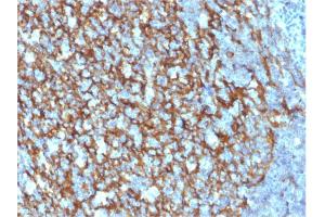 Formalin-fixed, paraffin-embedded human Tonsil stained with CD21 / CR2 Mouse Monoclonal Antibody (CR2/1952).