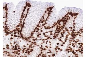 Immunohistochemistry (IHC) image for anti-Tumor Protein P53 (TP53) (N-Term) antibody (ABIN6263970)