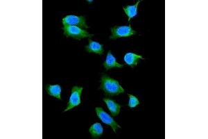 IF analysis of Galectin 1 using anti-Galectin 1 antibody (ABIN5518716).