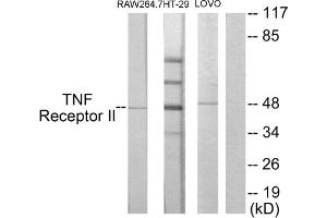 Western blot analysis of extracts from RAW264. (TNFRSF1B 抗体  (C-Term))
