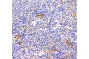 IHC analysis of CD229 using anti-CD229 antibody (ABIN6719290). (LY9 抗体)