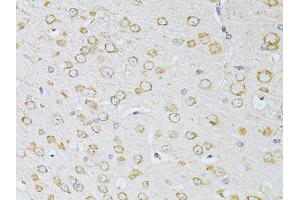 Immunohistochemistry of paraffin-embedded mouse brain using NTS antibody (ABIN5998396) at dilution of 1/100 (40x lens). (Neurotensin 抗体)