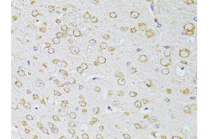 Immunohistochemistry of paraffin-embedded mouse brain using NTS antibody (ABIN5998396) at dilution of 1/100 (40x lens). (Neurotensin 抗体)