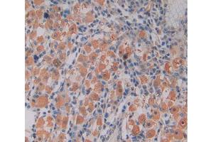 IHC-P analysis of stomach tissue, with DAB staining.