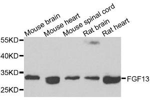 Western blot analysis of extracts of various cell lines, using FGF13 antibody. (FGF13 抗体  (AA 1-245))