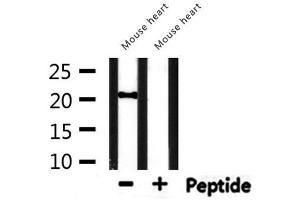 Western blot analysis of extracts from mouse heart, using CBX5 Antibody. (CBX5 抗体  (Internal Region))