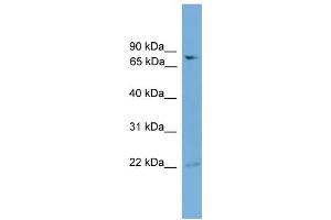 WB Suggested Anti-GFPT2 Antibody Titration:  0. (GFPT2 抗体  (N-Term))