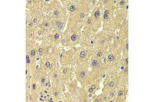 Immunohistochemistry of paraffin-embedded Human liver injury using ALDH1L1 antibody at dilution of 1:100 (x400 lens). (ALDH1L1 抗体)