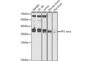 Western blot analysis of extracts of various cell lines, using PP1 beta antibody (ABIN6128486, ABIN6146055, ABIN6146057 and ABIN6217560) at 1:1000 dilution. (PPP1CB 抗体  (AA 1-327))