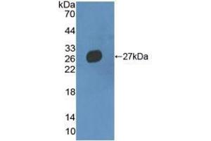 Western blot analysis of recombinant Mouse MMRN2.