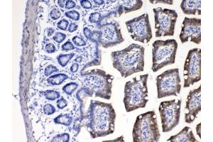 Immunohistochemistry (IHC) image for anti-Cytochrome P450, Family 2, Subfamily D, Polypeptide 6 (CYP2D6) (AA 315-347) antibody (ABIN5647528)