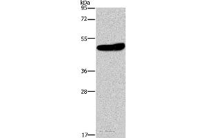 Western blot analysis of Mouse brain tissue, using KCNG2 Polyclonal Antibody at dilution of 1:650 (Kcng2 抗体)
