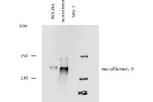 Western blotting analysis of human neurofilament H protein using mouse monoclonal antibody NF-05 on lysates of HEK-293 cell line, human brain lysate, and MCF-7 cell line (neurofilament non-expressing cell line, negative control) under reducing conditions. (NEFH 抗体)