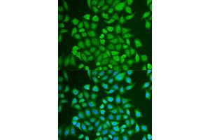 Immunofluorescence analysis of U2OS cell using PIP antibody. (PIP 抗体)