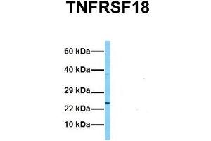 Host:  Rabbit  Target Name:  TNFRSF18  Sample Tissue:  Human HCT116  Antibody Dilution:  1. (TNFRSF18 抗体  (C-Term))