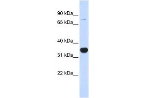 Western Blotting (WB) image for anti-Ras Homolog Gene Family, Member T1 (RHOT1) (N-Term) antibody (ABIN635090)