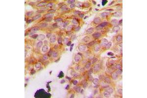 Immunohistochemistry (IHC) image for anti-Collagen, Type XI, alpha 1 (COL11A1) (Center) antibody (ABIN7295332)
