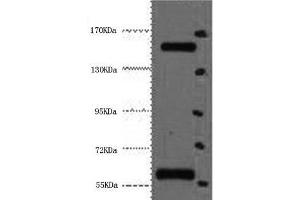 Western Blot analysis of Hela cells using CD45 Monoclonal Antibody at dilution of 1:2000. (CD45 抗体)